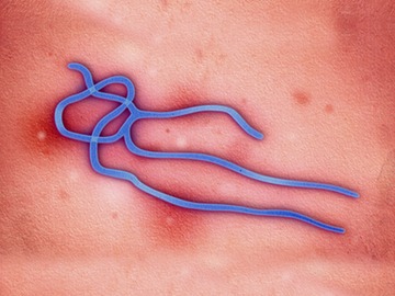 insidious-ebola-causing-harm-in-a-way-that-is-gradual-or-not-easily-noticed-harmful-but-enticing-ambush